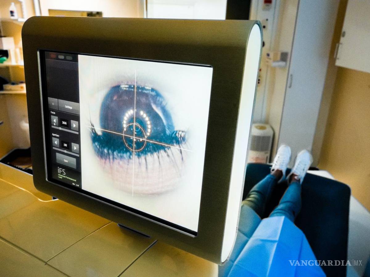 $!La interfaz del láser de femtosegundo se utiliza para cortar y remodelar la córnea.