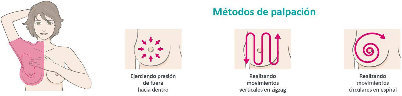 $!¿Cómo hacerse un autoexamen de exploración para detectar el cáncer de mama?