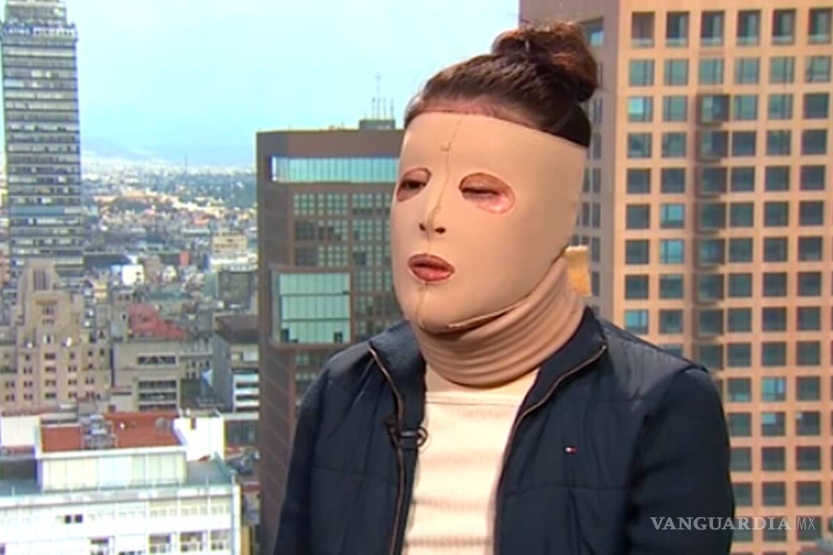 Hasta 2021 sentencia contra agresor de saxofonista en Oaxaca