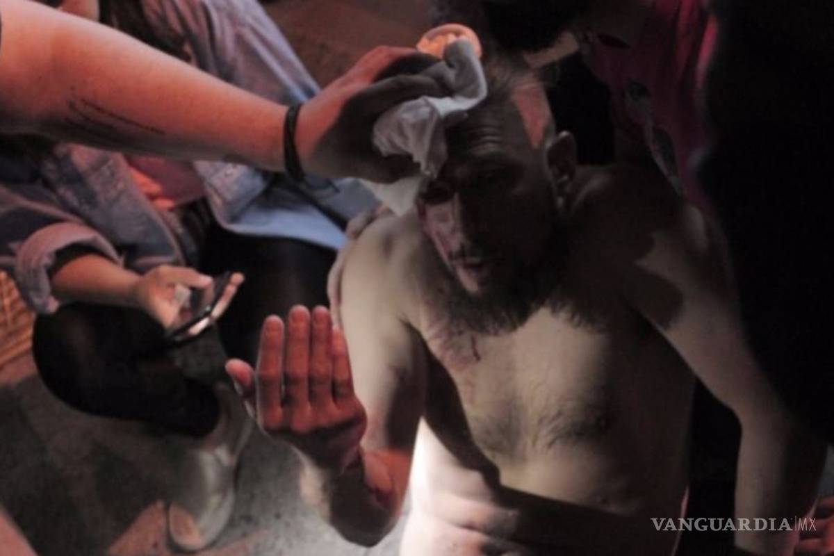 Atacan con palo de hockey en Marcha de Orgullo gay a un hombre, la multitud lucha otra vez