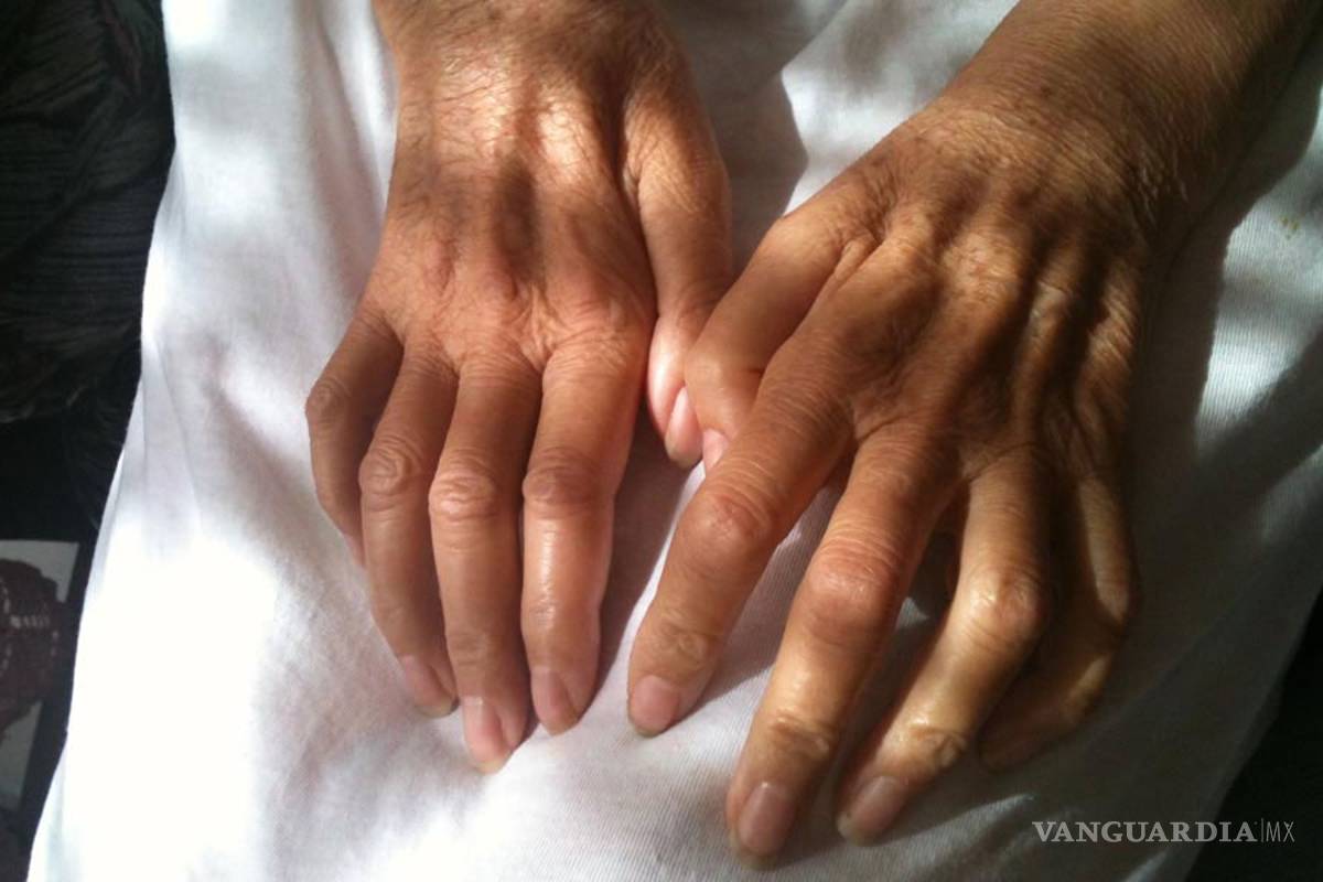 Muy cerca la creación de un medicamento contra la enfermedad de Stephen Hawking