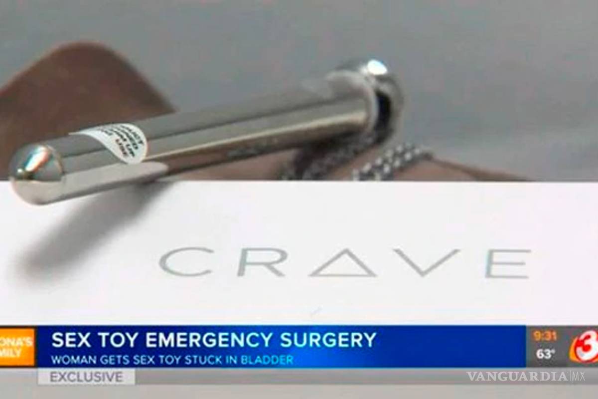 $!Juguete sexual llegó hasta su vejiga, tuvo que ser operada de emergencia