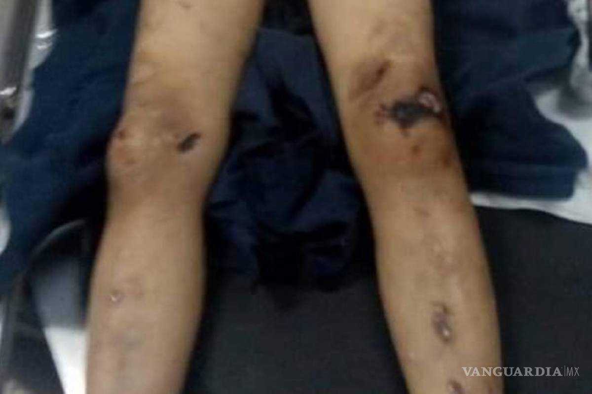 $!Pareja del mismo sexo asesina a su hijo por negarse a vestir como niña en Guanajuato