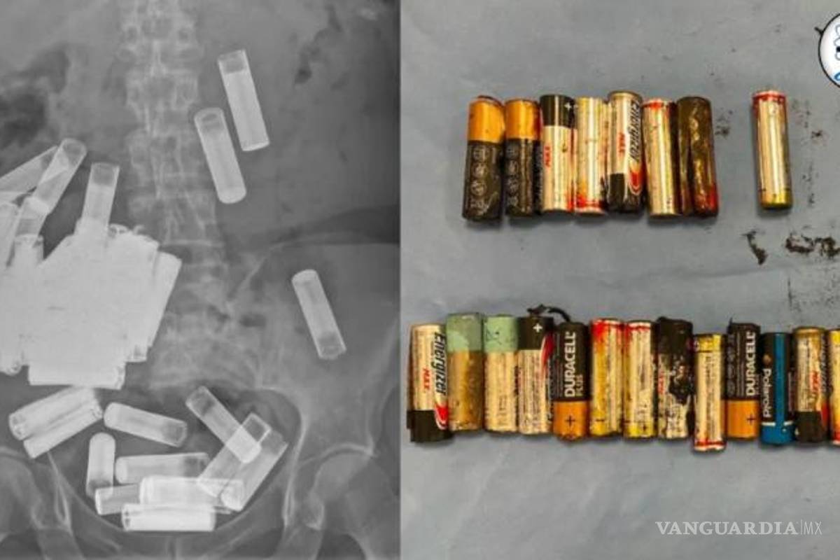 Mujer se traga 55 pilas para intentar quitarse la vida; logra sobrevivir