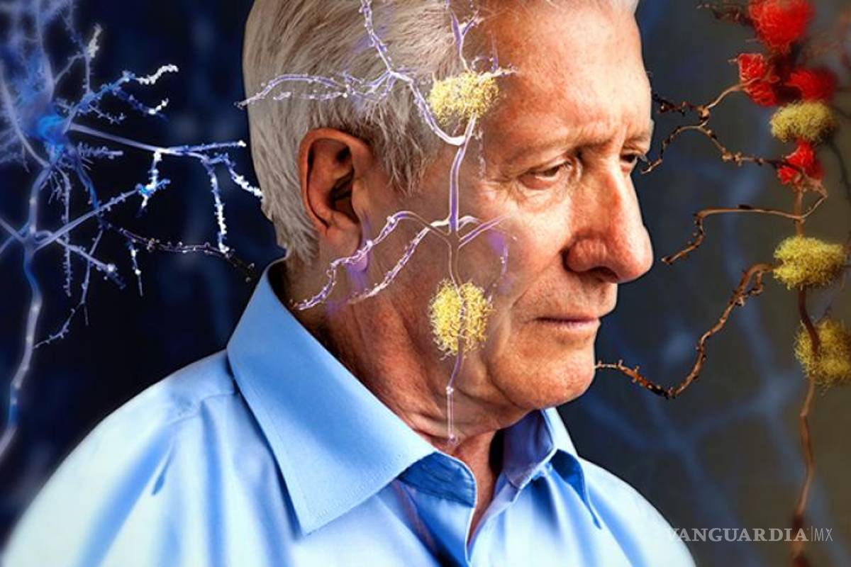 Vacuna de ADN podría retrasar aparición de Alzheimer