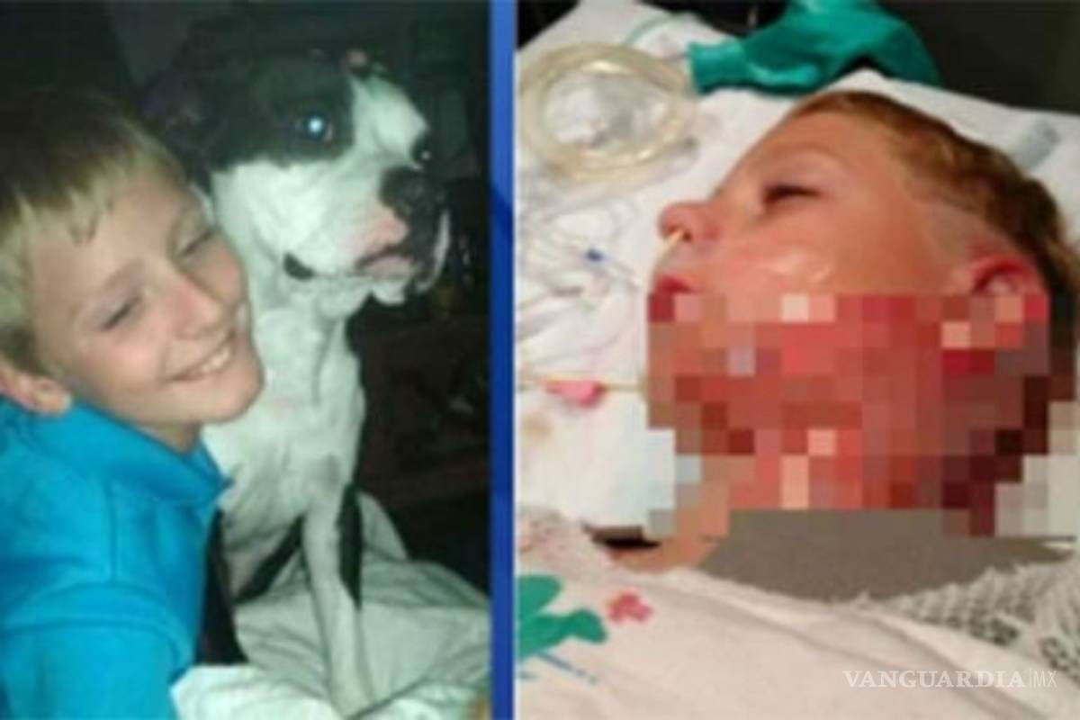 ‘Hot water challenge’, el peligroso y absurdo reto viral