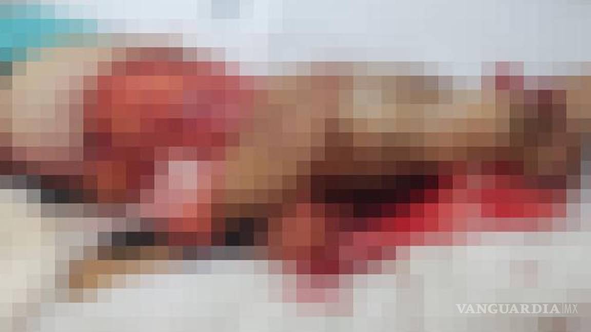 $!Familiares de Aglaé ¨N¨ esperan avances mientras la mujer permanece grave en el hospital.