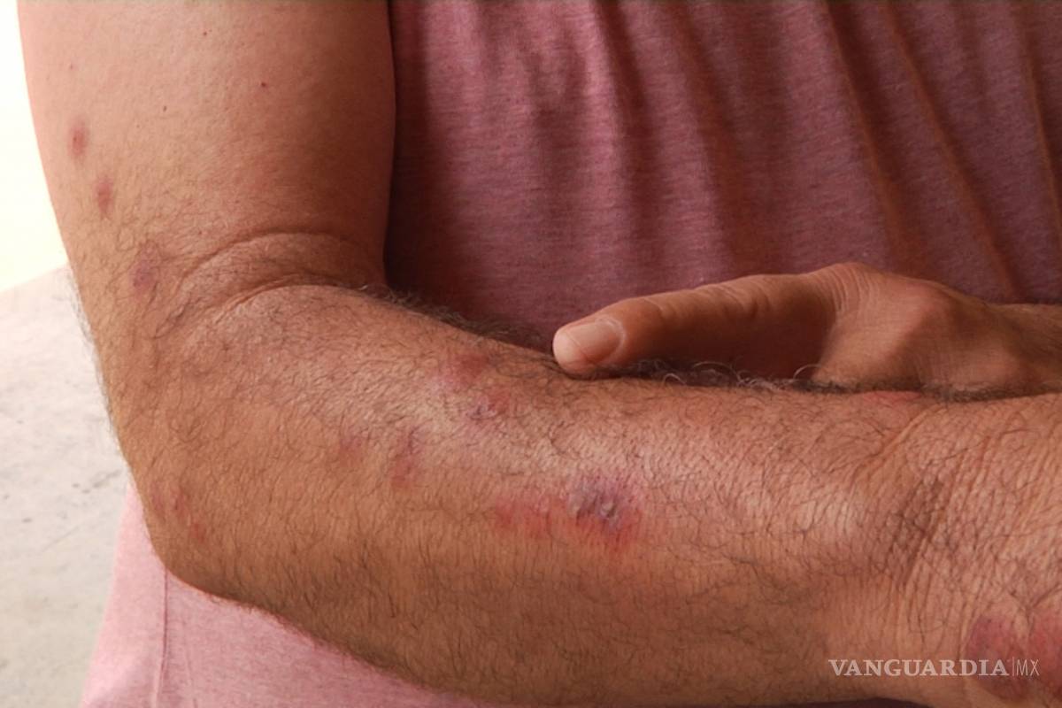 $!Chinches: toma tus precauciones para que no seas su presa fácil