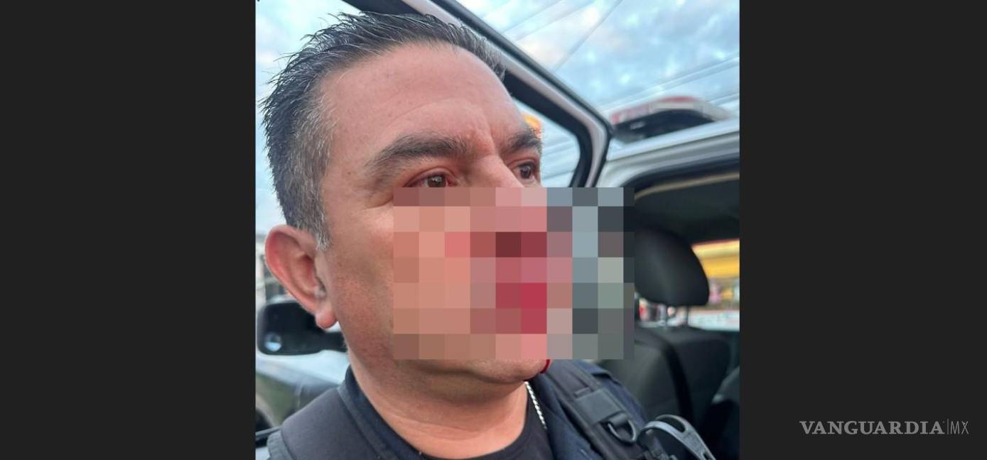 Saltillo: autoridades aseguran que detenido en Mirasierra no fue golpeado, pero él sí agredió a un policía