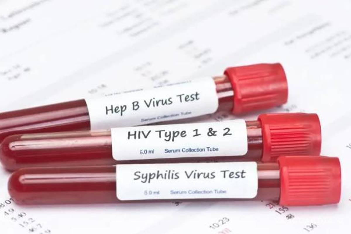 EU en medio de una epidemia de ETS ‘fuera de control’