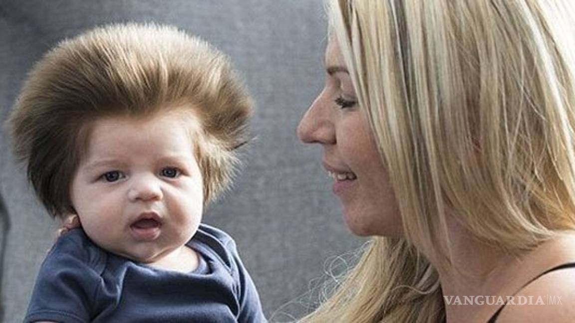 $!¿Por qué algunos bebés nacen calvos y otros con cabello?