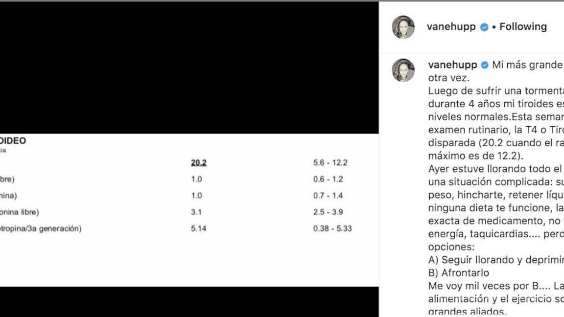 $!Vanessa Huppenkothen confiesa que una grave enfermedad regresó a su cuerpo