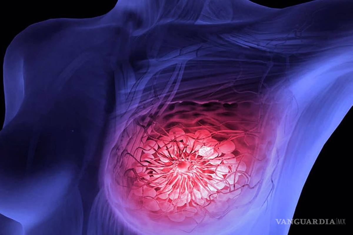 70% de mujeres con cáncer de mama pueden evitar 'quimio'