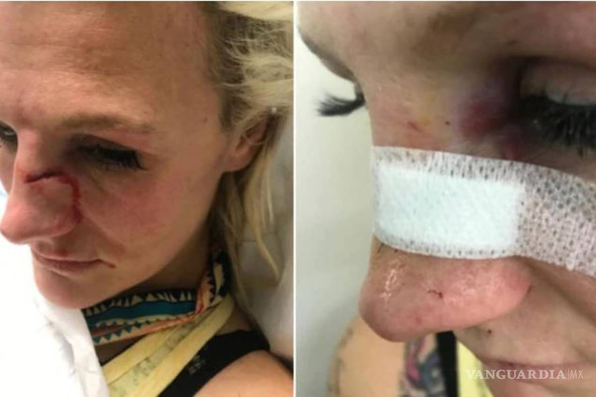 La brutal agresión de una peleadora de MMA a manos de su exnovio