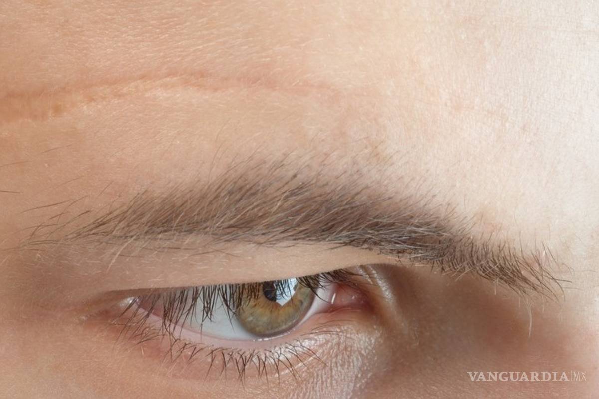 Cicatrices pueden causar depresión y hasta suicidio