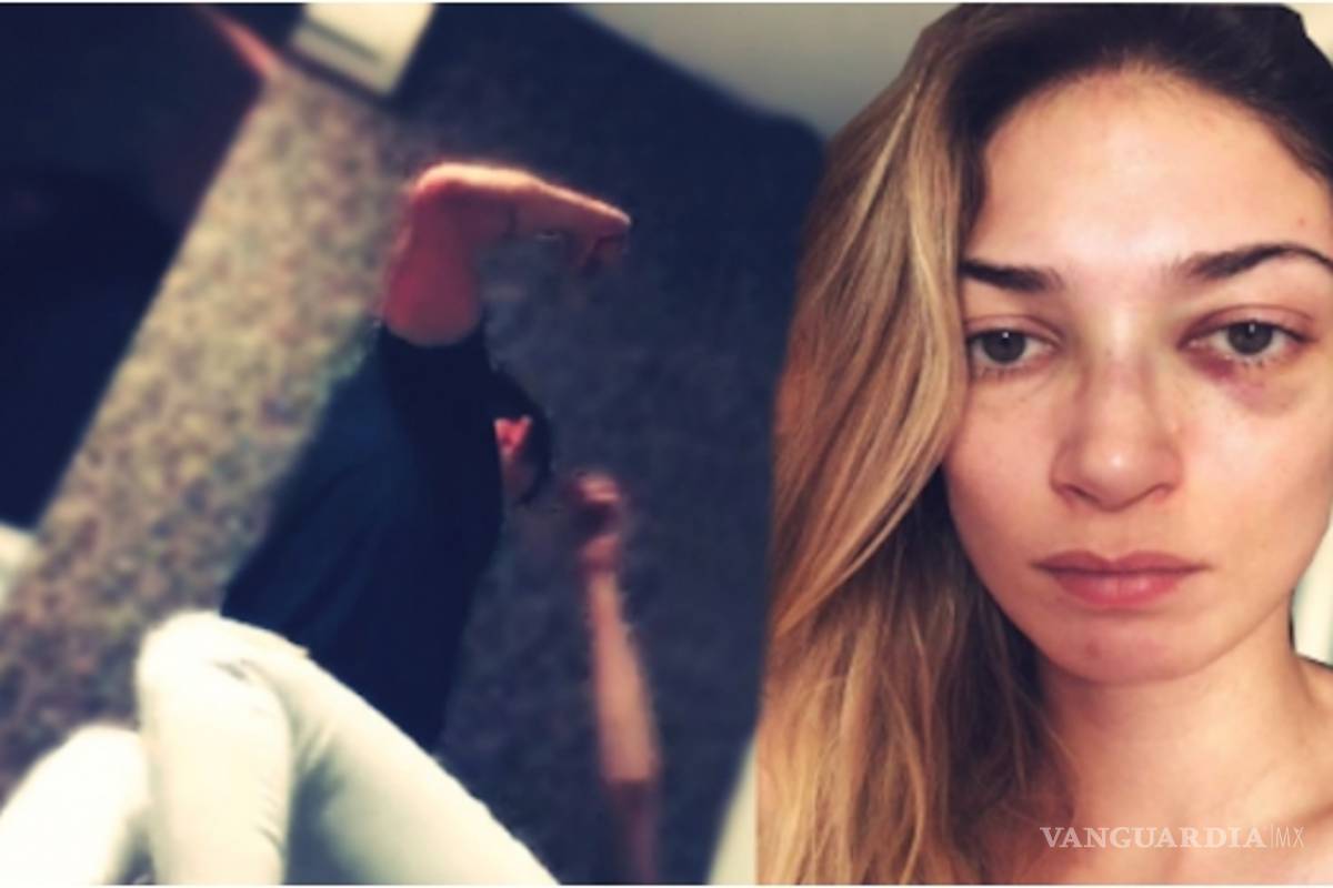 Mujer graba el momento en que su ex pareja la golpea e intenta asfixiarla (video)