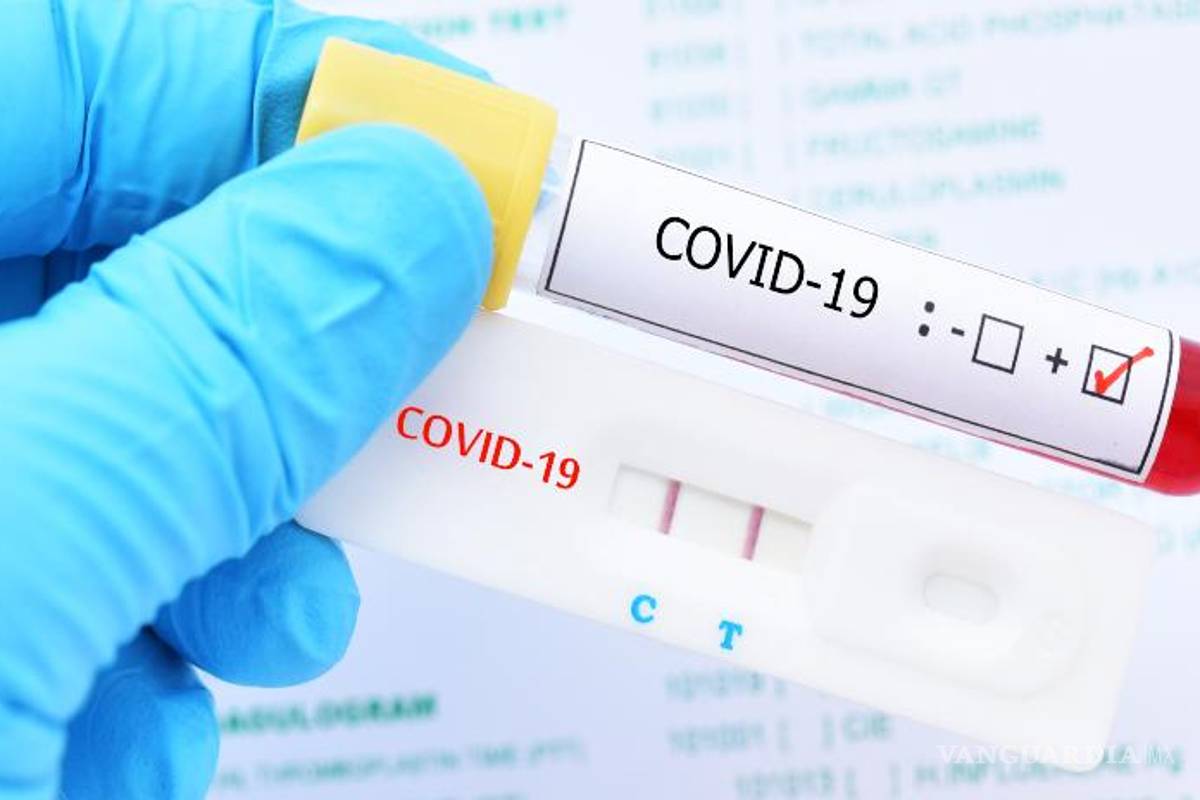 Coahuila; exhorta congreso a Profeco para regular precios de pruebas COVID-19