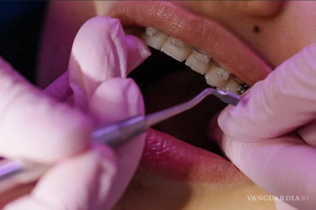 Coahuila: Especialízate en Ciencias Odontológicas con acentuación en Ortodoncia; la UAdeC impartirá maestría