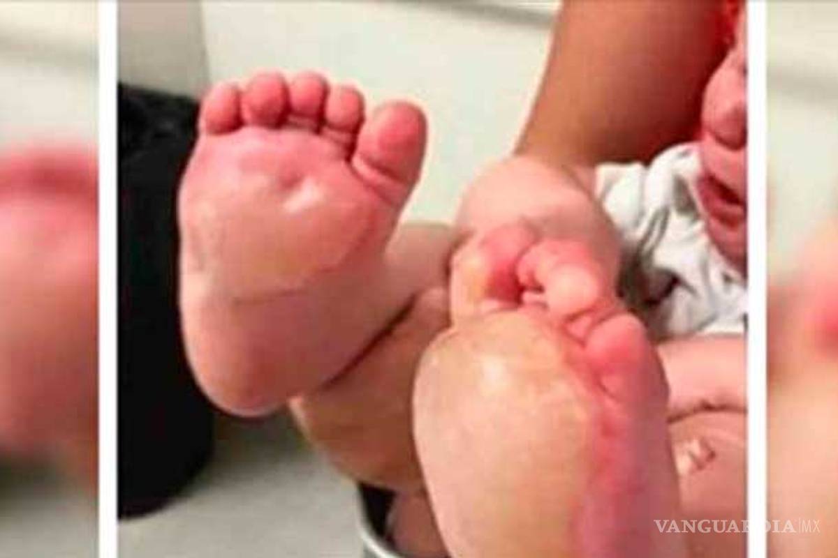 Padres torturaban a sus hijas, a una le quemaron los pies, en Durango