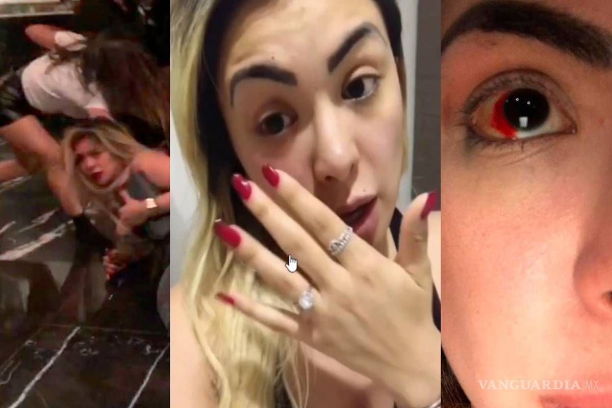 Así fue la impactante golpiza que recibió una actriz de Televisa (Video)