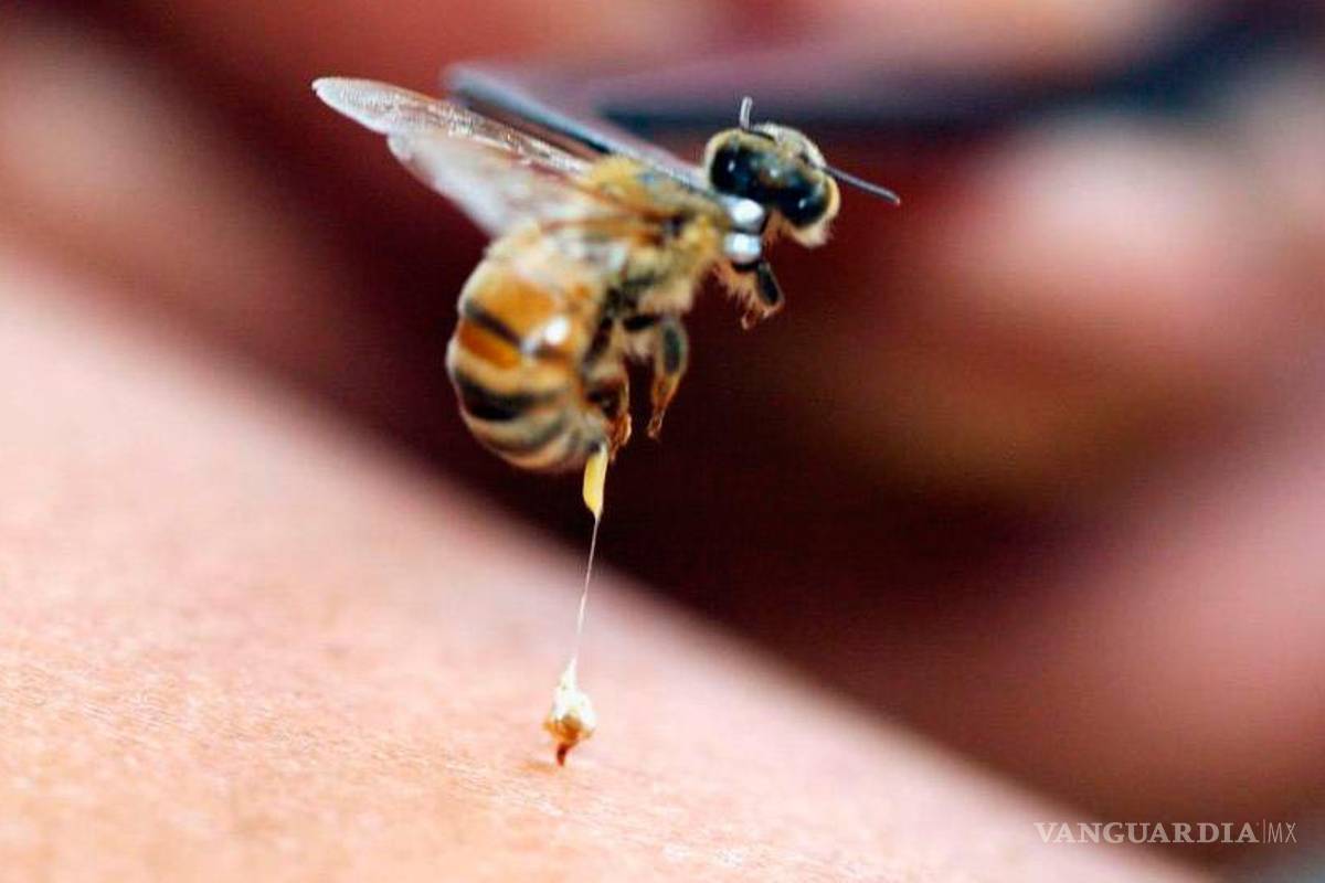 ¿Te picó algo y no sabes qué fue? Las 7 picaduras más comunes, sus síntomas y consecuencias