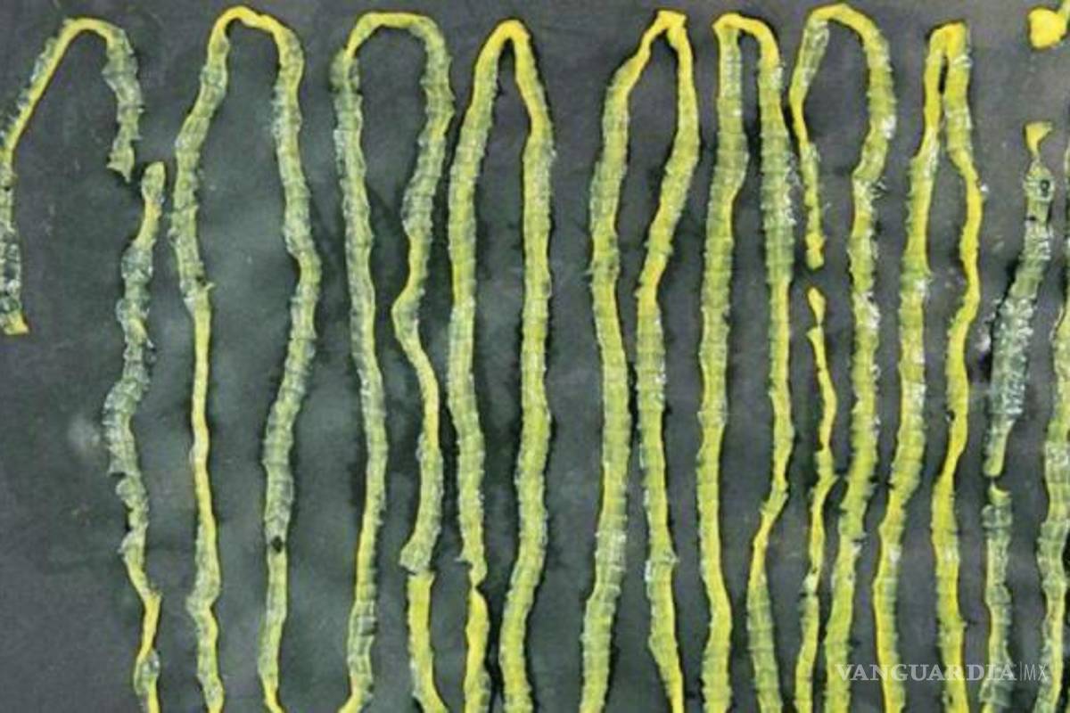 Lombriz de casi tres metros estaba dentro de un hombre