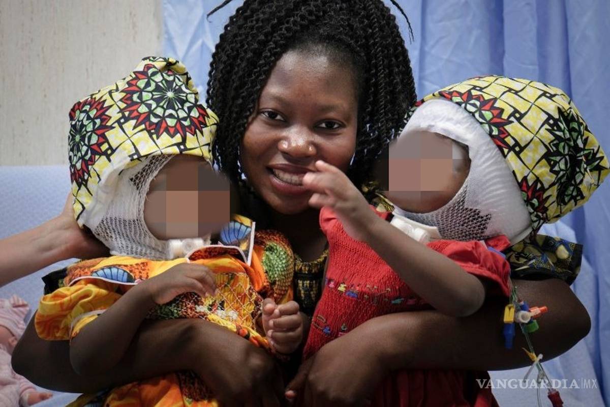 $!Papa Francisco bautiza a las niñas siamesas unidas por la cabeza que fueron operadas en Roma