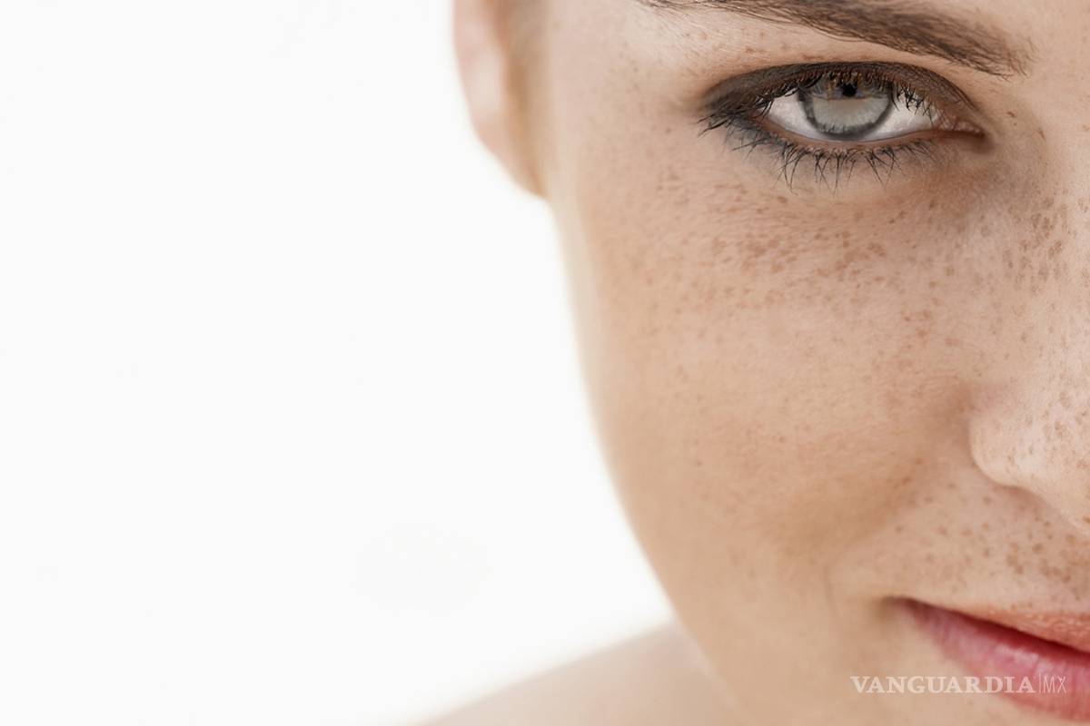 Mujeres con pecas son más atractivas para los hombres