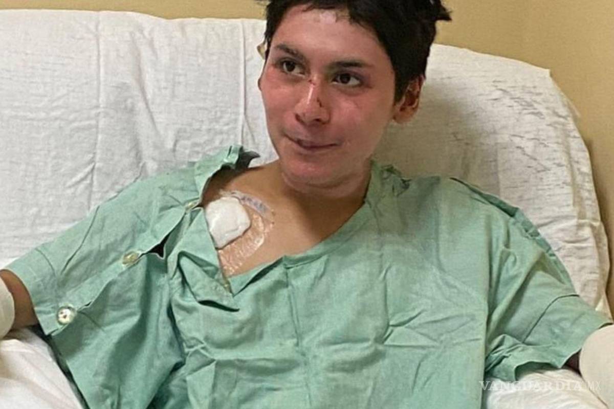 ‘Sentí como mis ojos y oídos se quemaban’: narra Daniel sobre explosión en restaurante Danny’s de Monclova