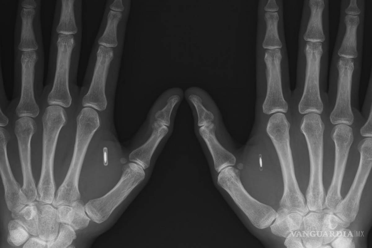 Contraseñas corporales, la nueva tendencia en bancos, empresas y gobiernos