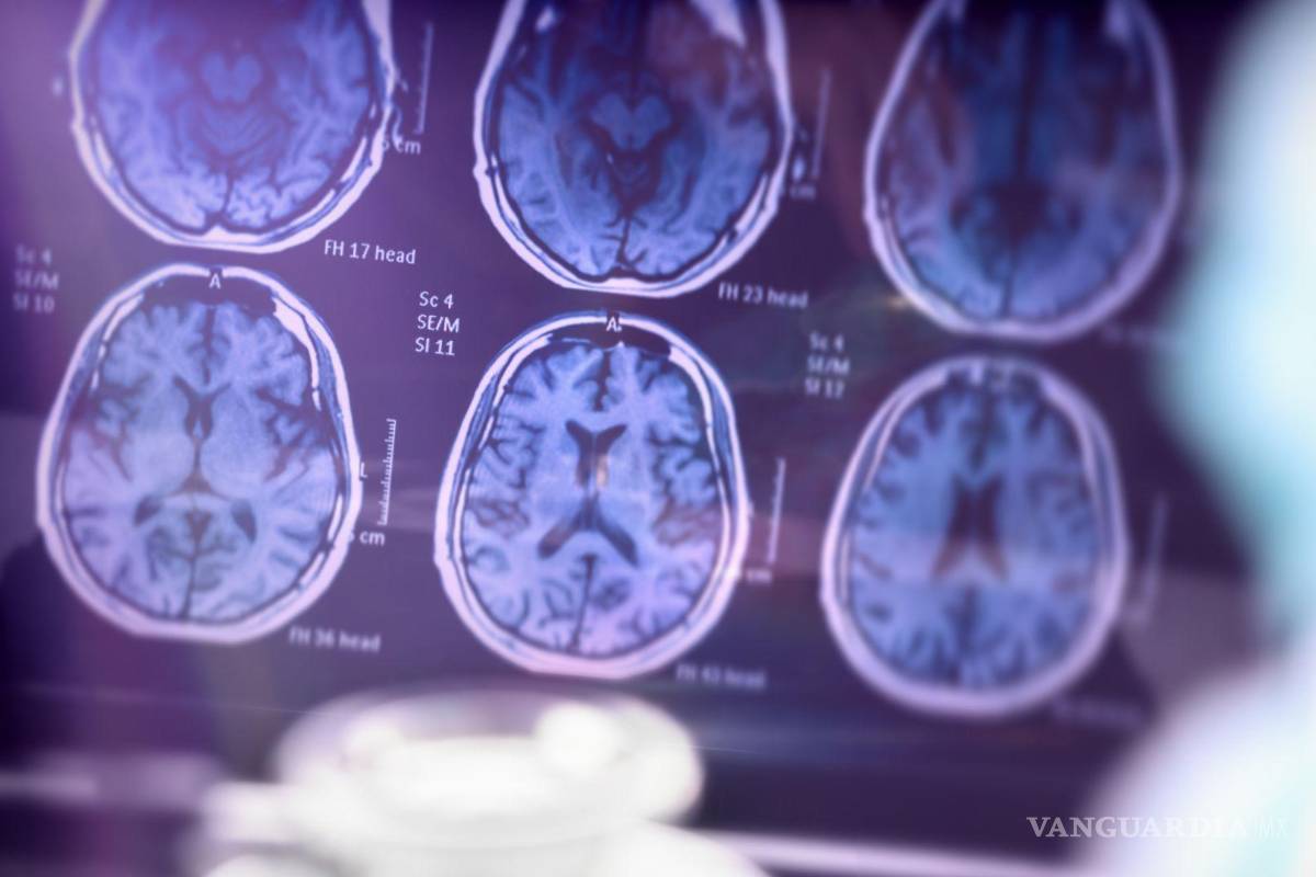 Aplicarán test para detectar síntomas de demencias y Alzheimer en Coahuila
