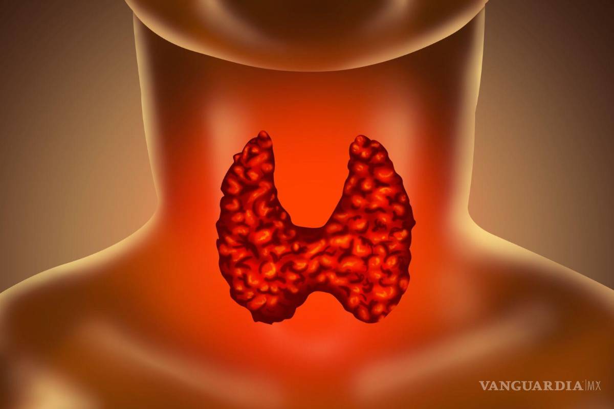 Cuidado, Saltillo: Virus de Papiloma Humano puede causar cáncer de garganta