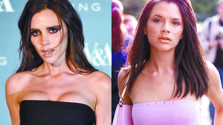 Victoria Beckham se arrepiente de sus implantes