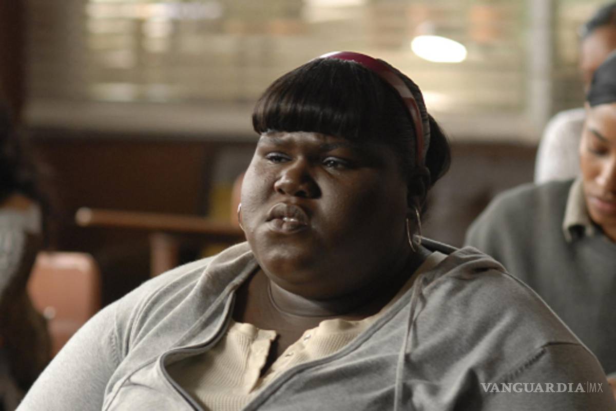 "Precious" se sometió a cirugía para bajar de peso