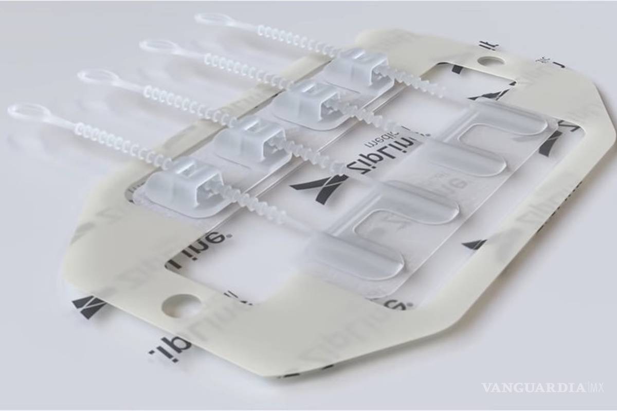 $!ZipStitch, con este dispositivo podrás cerrar heridas sin sutura