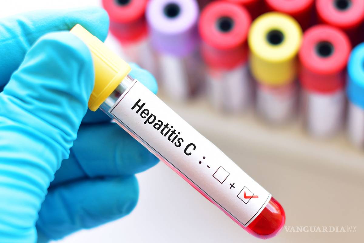 Hepatitis C, una enfermedad silenciosa que puede desarrollar cirrosis o cáncer