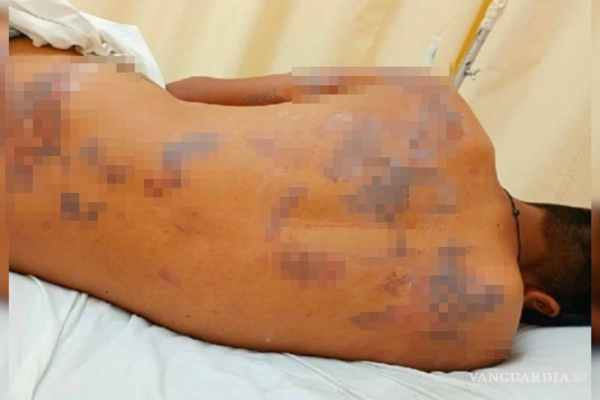 Atan y torturan a joven en Allende; el agresor sigue prófugo