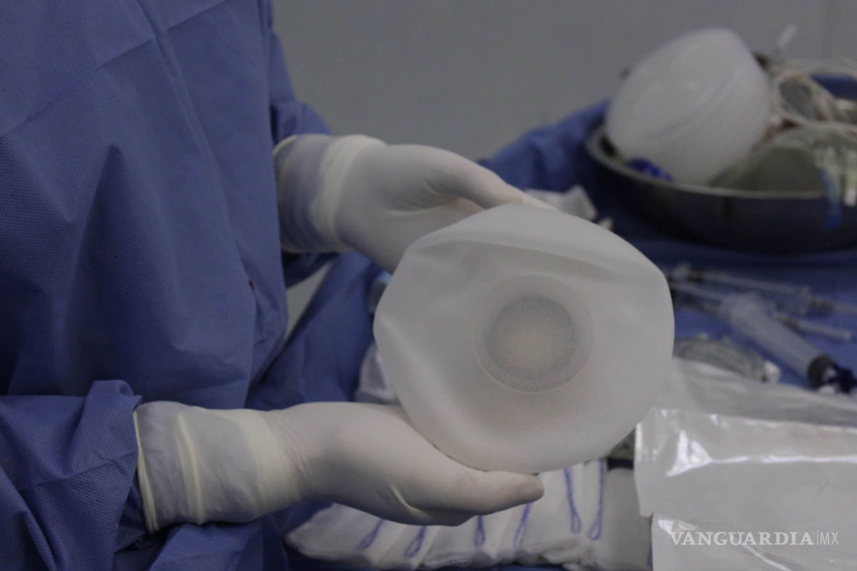 Reconstrucción mamaria gratuita: ¿Dónde y quiénes pueden acceder a este beneficio?