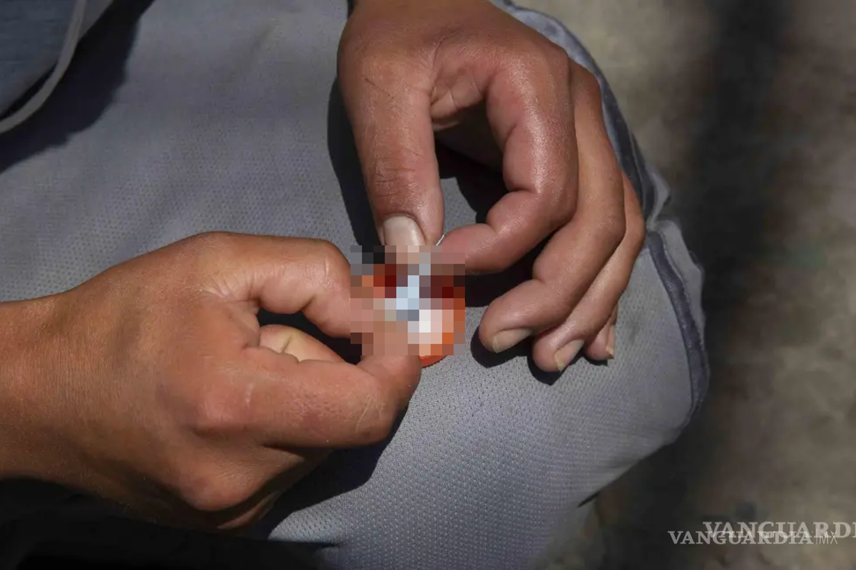 SS sigue sin registrar casos de fentanilo en Coahuila