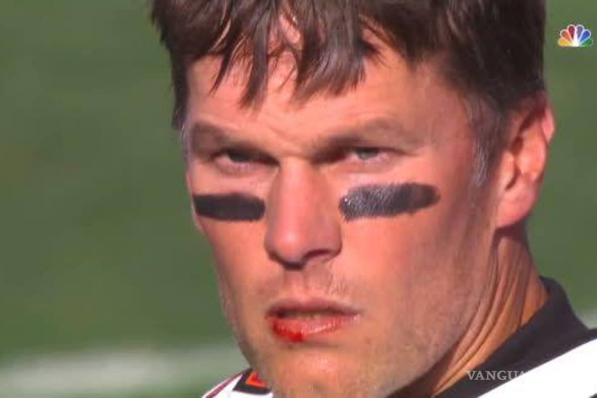 Por primera vez en su carrera, Brady fue castigado por conducta luego de golpe que le cortó el labio