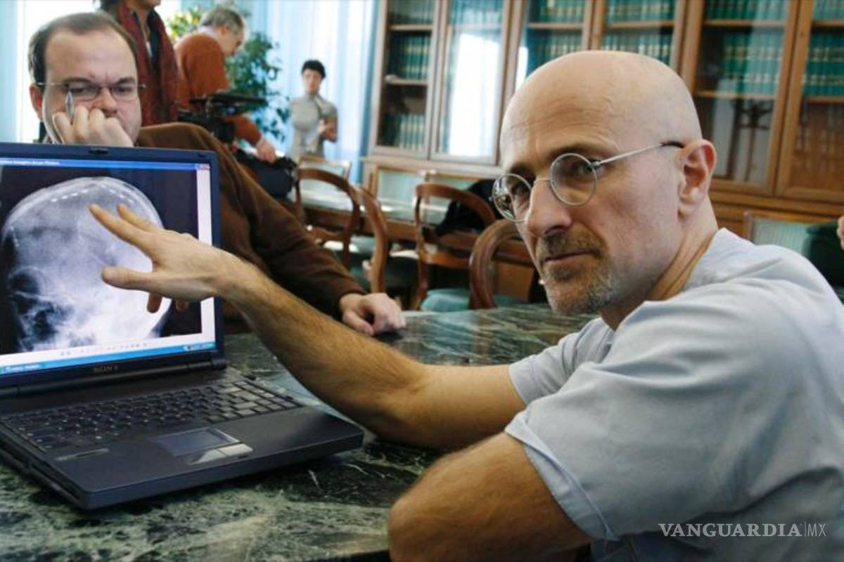 Avanza transplante de cabeza, afirman que están listos para realizarlo en personas vivas