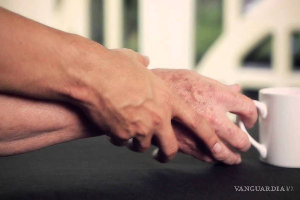 $!Los 10 síntomas tempranos para saber si padeces Parkinson