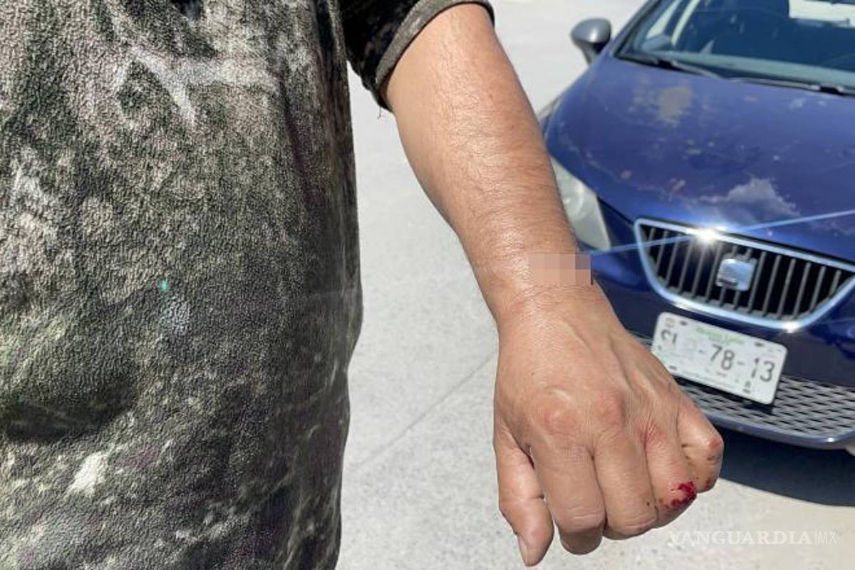 $!La violencia estalló en las calles de la ciudad cuando un conflicto desencadenó un ataque.