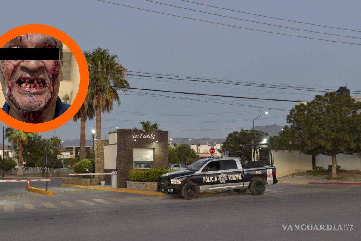 Rechaza don Pedro, vigilante agredido en Saltillo, ayuda para sus dientes; tiene necesidades más urgentes, señala