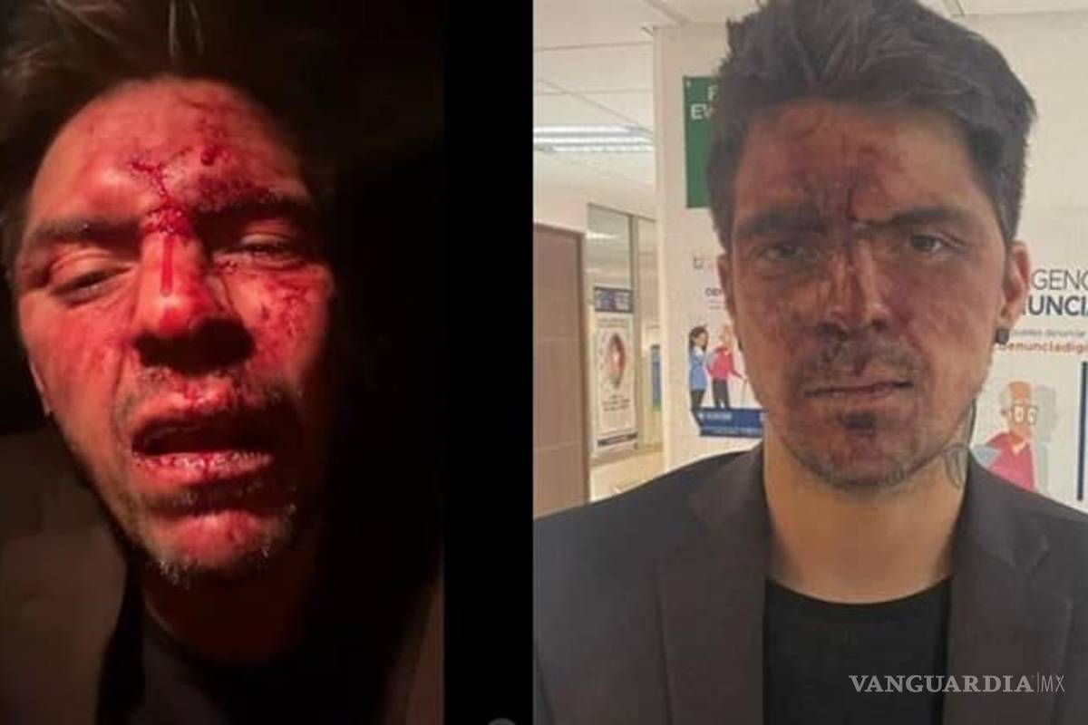 Acusan abuso sexual en agresión a hijo de Lupita D'Alessio en fiesta de Montiel