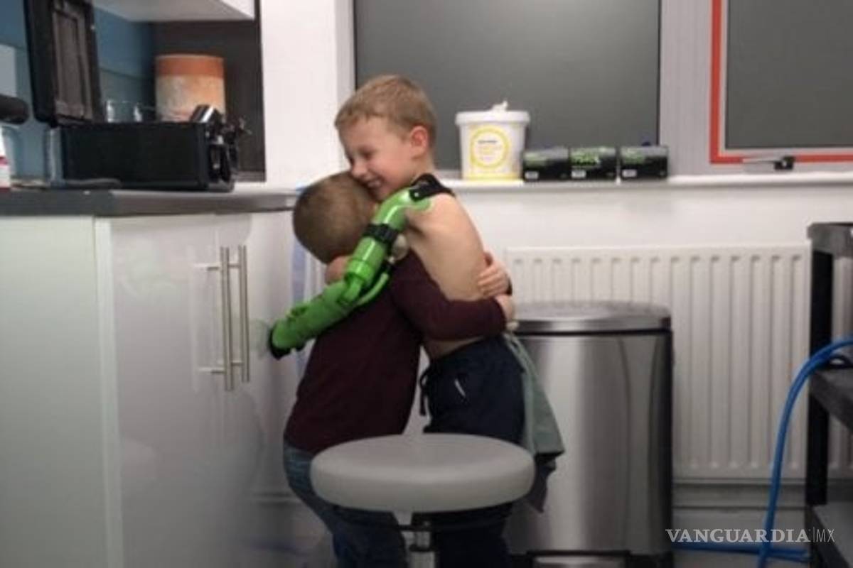 Padres le regalan de Navidad a su hijo de 5 años, un brazo biónico; nació sin su extremidad izquierda