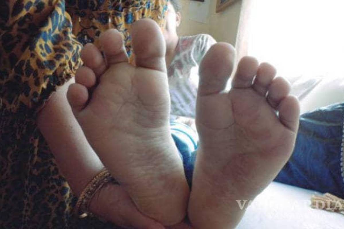 Jovencita de Saltillo que padece Sturge Weber, recibe sus zapatos soñados