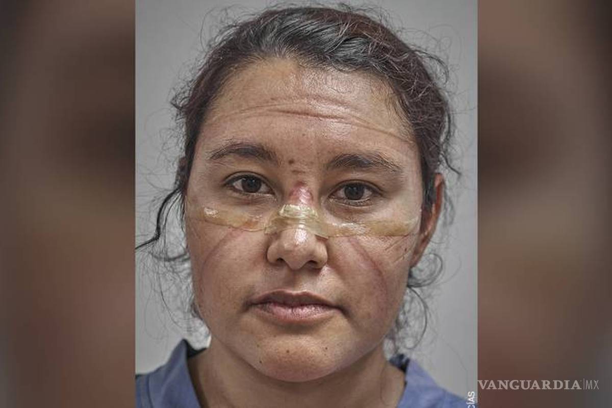 Conquista fotógrafo mexicano el World Press Photo 2021 con foto de “huellas” de COVID en personal médico