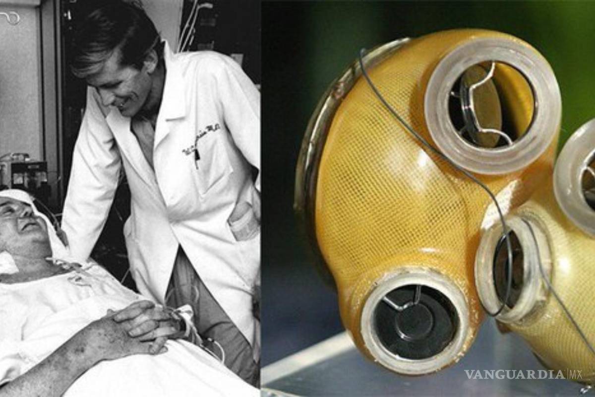 Hace 40 años Barney Clark recibió el primer trasplante artificial de corazón