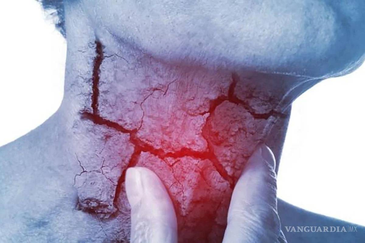 Coahuila: Cáncer de cabeza y cuello: una amenaza creciente entre jóvenes por salud bucal y sexual descuidada